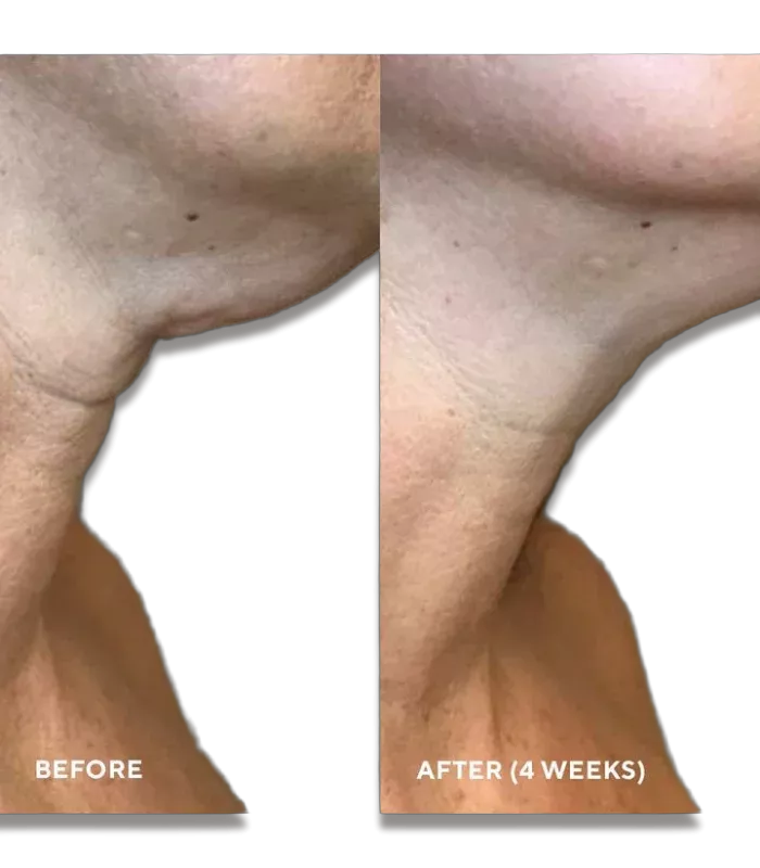 Ліфтинг-сироватка для зони декольте HydroPeptide Firm-A-Fix Nectar 50mL