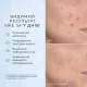 СИРОВАТКА ДЛЯ ОБЛИЧЧЯ З НІАЦИНАМІДОМ 10% NIACINAMIDE PEPTIDES MEDIK8