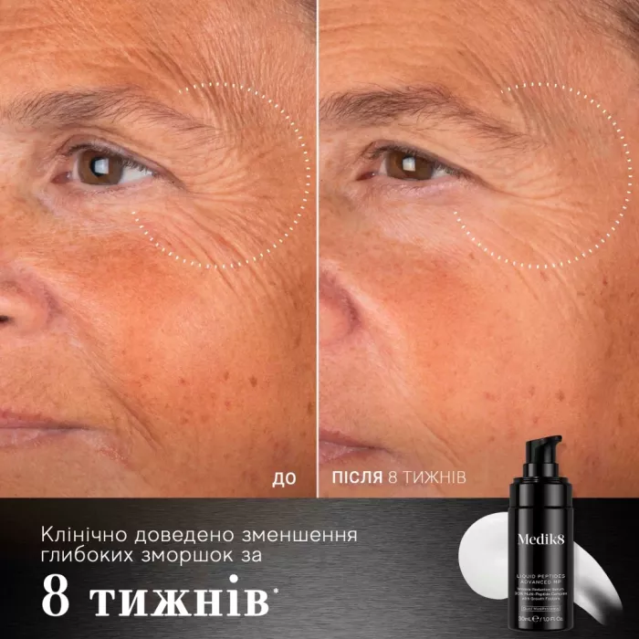 СИРОВАТКА ДЛЯ ОБЛИЧЧЯ З ПЕПТИДАМИ LIQUID PEPTIDES ADVANCED MP MEDIK8