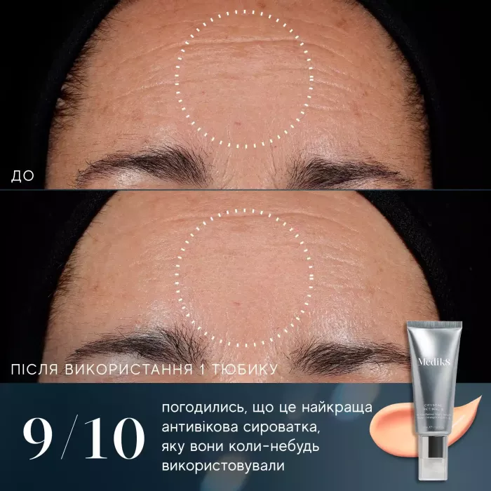 Crystal Retinal 24
