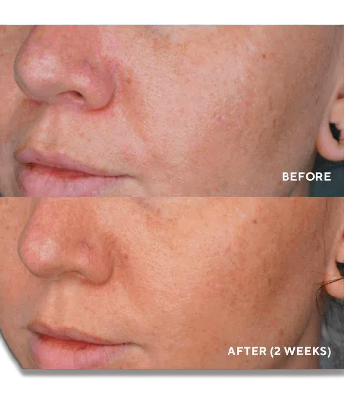 Сироватка для усунення пігментації HydroPeptide LumaPro-С 30mL