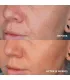 Сироватка для усунення пігментації HydroPeptide LumaPro-С 30mL