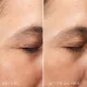 CRYSTAL RETINAL® CERAMIDE EYE  6